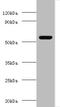 Matrix Metallopeptidase 3 antibody, A55223-100, Epigentek, Western Blot image 