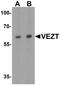 Vezatin, Adherens Junctions Transmembrane Protein antibody, PA5-72819, Invitrogen Antibodies, Western Blot image 