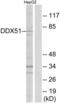 DEAD-Box Helicase 51 antibody, LS-C119767, Lifespan Biosciences, Western Blot image 