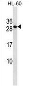 Transmembrane P24 Trafficking Protein 6 antibody, AP54285PU-N, Origene, Western Blot image 