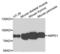 Adenosine Monophosphate Deaminase 1 antibody, LS-C409425, Lifespan Biosciences, Western Blot image 