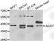 Jumonji Domain Containing 7 antibody, A7408, ABclonal Technology, Western Blot image 