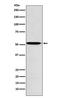 ALK4 antibody, M02882, Boster Biological Technology, Western Blot image 