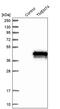 Transmembrane Protein 74 antibody, PA5-53363, Invitrogen Antibodies, Western Blot image 