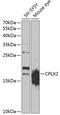 Complexin 2 antibody, GTX33116, GeneTex, Western Blot image 