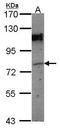 Cell Cycle Associated Protein 1 antibody, GTX112462, GeneTex, Western Blot image 
