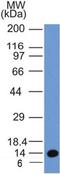 Early Endosome Antigen 1 antibody, NBP2-36568, Novus Biologicals, Western Blot image 