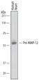 Matrix Metallopeptidase 12 antibody, AF917, R&D Systems, Western Blot image 