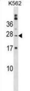Poly(A) Binding Protein Cytoplasmic 1 Like 2B antibody, abx030671, Abbexa, Western Blot image 