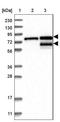 Transmembrane And Tetratricopeptide Repeat Containing 2 antibody, NBP1-85027, Novus Biologicals, Western Blot image 