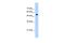 Interferon Induced Protein With Tetratricopeptide Repeats 3 antibody, PA5-42807, Invitrogen Antibodies, Western Blot image 