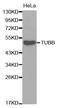 Tubulin antibody, A0482, ABclonal Technology, Western Blot image 