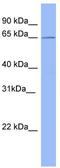 N6-adenosine-methyltransferase 70 kDa subunit antibody, TA345273, Origene, Western Blot image 