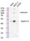 Septin 6 antibody, STJ95615, St John