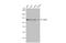 CYLD Lysine 63 Deubiquitinase antibody, GTX100228, GeneTex, Western Blot image 