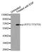 Activating Transcription Factor 2 antibody, MBS128303, MyBioSource, Western Blot image 