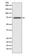 Receptor Interacting Serine/Threonine Kinase 1 antibody, M00141, Boster Biological Technology, Western Blot image 