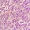 Mitofusin 2 antibody, abx121952, Abbexa, Western Blot image 