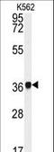 Neutrophil Cytosolic Factor 4 antibody, LS-C100269, Lifespan Biosciences, Western Blot image 