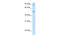 Aat1 antibody, 30-103, ProSci, Western Blot image 