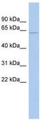 Outer Dense Fiber Of Sperm Tails 2 Like antibody, TA336158, Origene, Western Blot image 