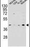 HERV-H LTR-Associating 2 antibody, PA5-24146, Invitrogen Antibodies, Western Blot image 