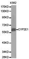 Cytochrome P450 Family 2 Subfamily E Member 1 antibody, LS-C192747, Lifespan Biosciences, Western Blot image 