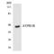 Arginine Vasopressin Receptor 1B antibody, LS-C200166, Lifespan Biosciences, Western Blot image 