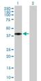 Complement Component 4 Binding Protein Beta antibody, H00000725-B01P, Novus Biologicals, Western Blot image 