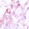 Janus Kinase 3 antibody, orb315571, Biorbyt, Immunohistochemistry paraffin image 