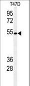 Protein O-Glucosyltransferase 1 antibody, LS-C165653, Lifespan Biosciences, Western Blot image 