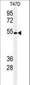 Protein O-glucosyltransferase 1 antibody, LS-C165653, Lifespan Biosciences, Western Blot image 