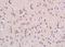 Lysine Acetyltransferase 8 antibody, orb157725, Biorbyt, Immunohistochemistry paraffin image 