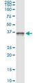 PIH1 Domain Containing 1 antibody, MA5-22090, Invitrogen Antibodies, Immunoprecipitation image 