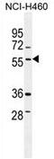 T-SNARE Domain Containing 1 antibody, AP54376PU-N, Origene, Western Blot image 