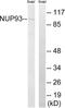 Nucleoporin 93 antibody, LS-C120170, Lifespan Biosciences, Western Blot image 