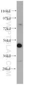 Ligand Dependent Nuclear Receptor Corepressor antibody, 14476-1-AP, Proteintech Group, Western Blot image 