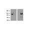 Leucine Rich Repeat Containing 36 antibody, TA320415, Origene, Western Blot image 