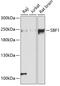 Myotubularin-related protein 5 antibody, A05858, Boster Biological Technology, Western Blot image 