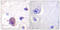 Protein Tyrosine Kinase 2 antibody, LS-C198949, Lifespan Biosciences, Immunohistochemistry paraffin image 