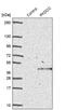 Protein kinase domain-containing protein, cytoplasmic antibody, NBP1-80758, Novus Biologicals, Western Blot image 