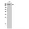 Epidermal Growth Factor antibody, LS-C383274, Lifespan Biosciences, Western Blot image 