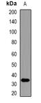 Interferon-inducible double stranded RNA-dependent protein kinase activator A antibody, abx142174, Abbexa, Western Blot image 