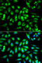 Cholinergic Receptor Muscarinic 2 antibody, 16-170, ProSci, Immunofluorescence image 