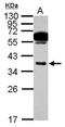 Chymase 1 antibody, GTX105829, GeneTex, Western Blot image 