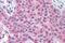 Matrix Metallopeptidase 13 antibody, NBP1-02339, Novus Biologicals, Immunohistochemistry frozen image 