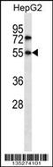 Nuclear Receptor Subfamily 4 Group A Member 3 antibody, 58-224, ProSci, Western Blot image 