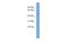 TRNA Methyltransferase 6 antibody, A13158, Boster Biological Technology, Western Blot image 