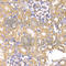 Leucine Aminopeptidase 3 antibody, A7101, ABclonal Technology, Immunohistochemistry paraffin image 