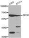 Erythropoietin receptor antibody, abx002139, Abbexa, Western Blot image 